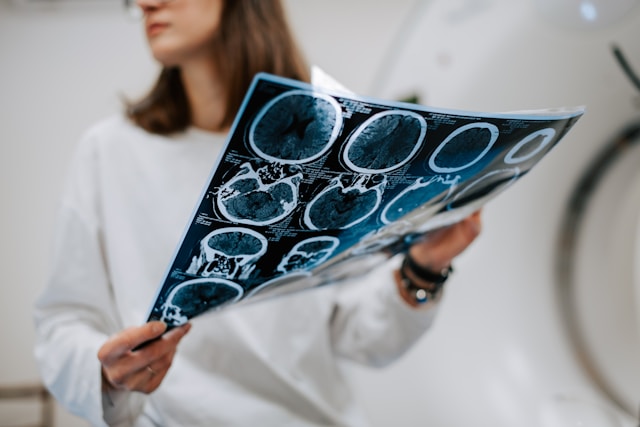 A medical professional in a white coat examines scan X-ray images.